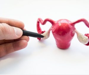 Anovulation