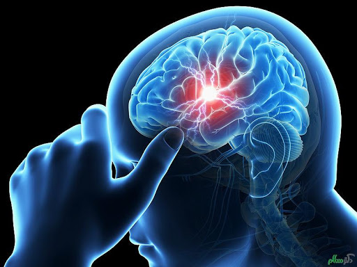 Neurological Disorders