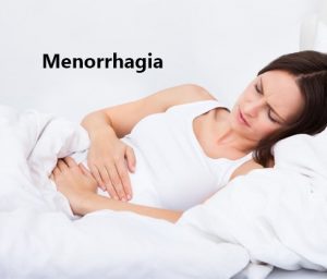 Menorrhagia